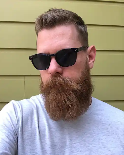 Bandholz beard